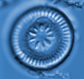 Diatom Image: Cyclotella stelligera